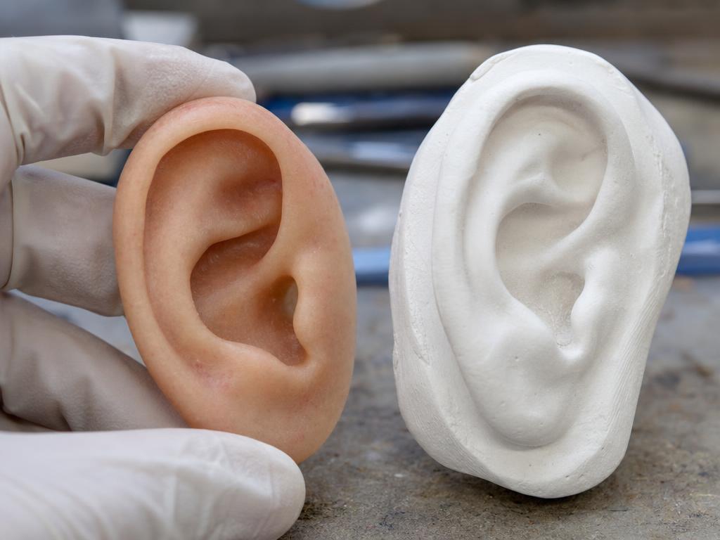 Silicone ear prosthesis with its matching plaster ear mould